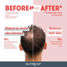 Nutricap Hair Loss 30 Softgels - Stronger & Longer Hair - Biotin, Zinc, Millet Extract, Vitamin E - 1 Month Treatment