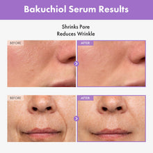 TOSOWOONG Bakuchiol Serum, 5,000ppm Bakuchiol, Anti-Aging, Pore Minimizer for Face, Hydrating Glow Serum, Facial Moisturizer, Active Skin Repair, Glass Skin, Korean Skincare, 30ml, 1.01 fl. oz.