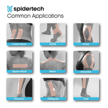 SpiderTech Gentle - Therapeutic Kinesiology Tape Roll for Hyper Sensitive and Radiated Skin | Physical Therapy Muscle Strains | High-Grade Water-Resistant Material | Shoulder, Wrist, Knee, Ankle